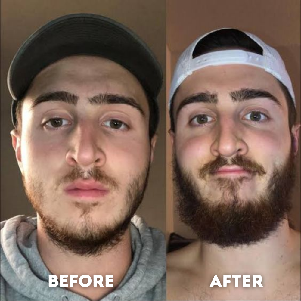 Beard Booster 2.0 ~ Stimule la croissance de la barbe